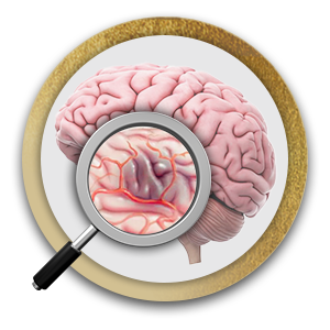 Risk of Stroke